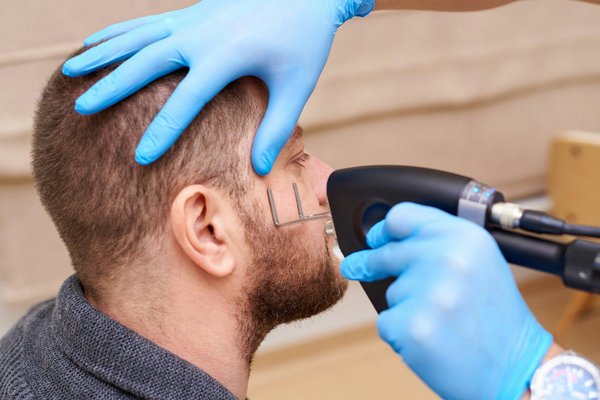 What Innovations in Laser Therapy Are Being Used for Treating Chronic Acne?